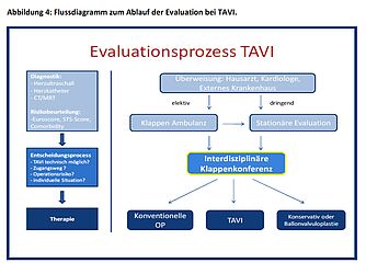 Evaluationsprozess bei TAVI