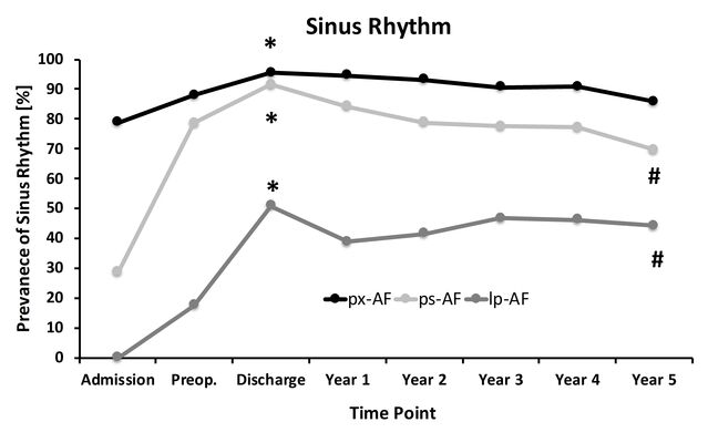 Sinusrhythmus Grafik im Verlauf