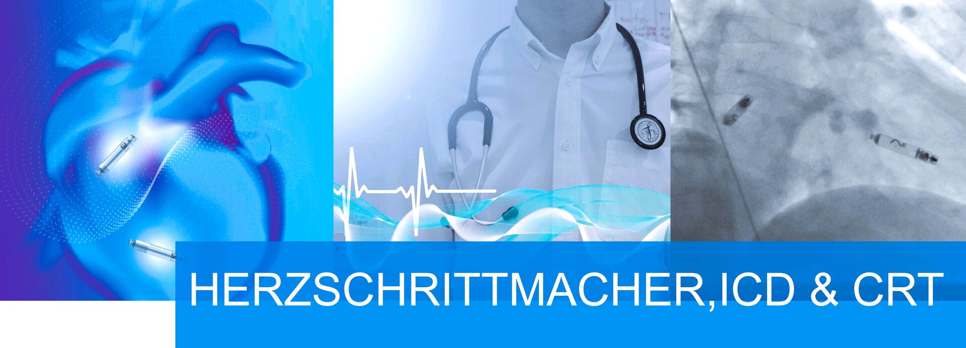 Herzschrittmacher, ICD,CRT