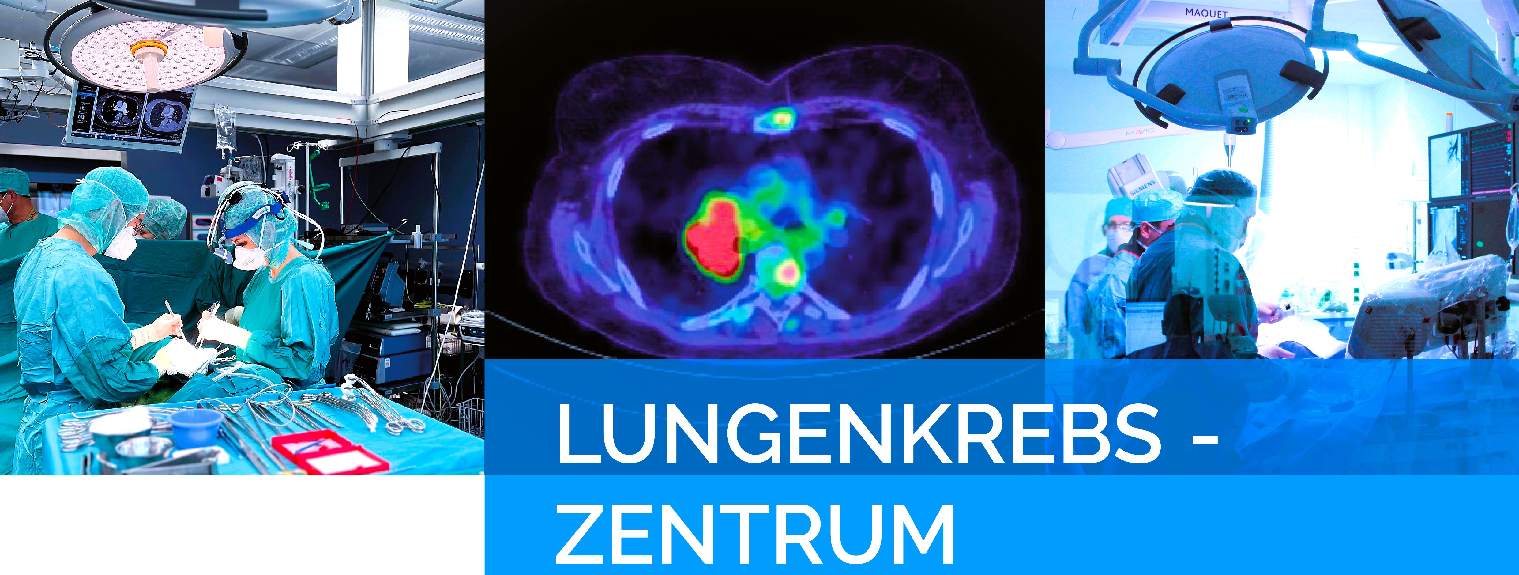 Lungenkrebszentrum Kerckhoff-Klinik
